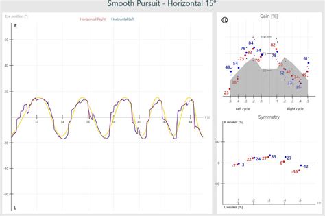 VisualEyes™ | Smooth Pursuit Eye Movement Testing | Interacoustics