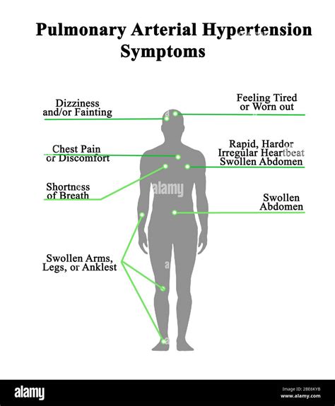 Hypertension pulmonaire Banque de photographies et d’images à haute résolution - Alamy