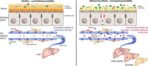 The gut-liver axis in liver disease: Pathophysiological basis for therapy - Journal of Hepatology