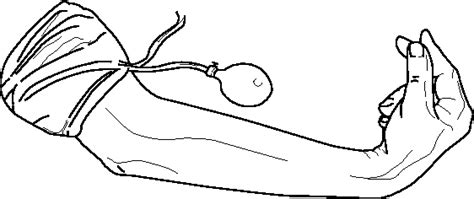 Signs of Hypocalcemia: Chvostek's and Trousseau's Signs | Semantic Scholar