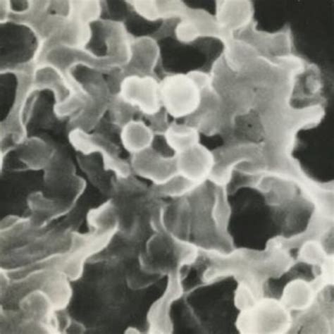 Fragment of formation of S. enteritidis clusters of spheroplast and... | Download Scientific Diagram