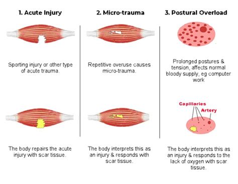 Ask the doc: What is Soft Tissue & Why Does it Matter?