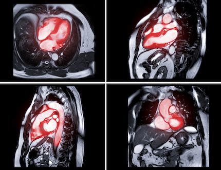 6 key heart tests and what they show | UTSW Medblog