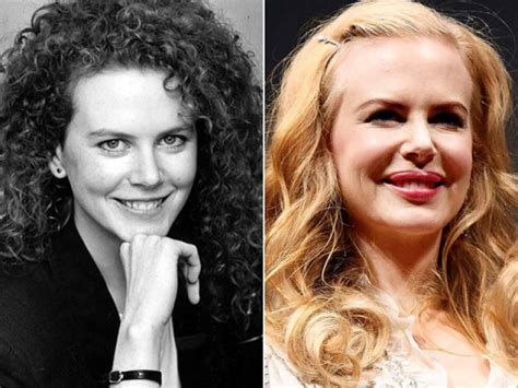 Nicole Kidman: 5 beauties who took plastic surgery too far