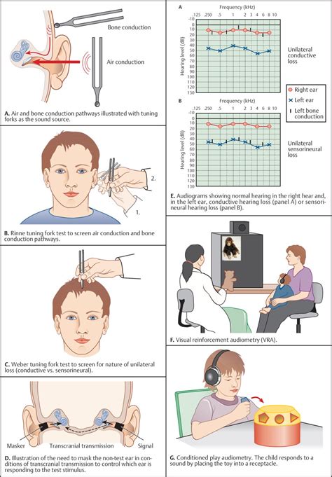 Otologic and Neurotologic Diagnostics and Tests | Neupsy Key