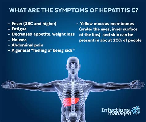 What are the symptoms of hepatitis C? | Infections Managed