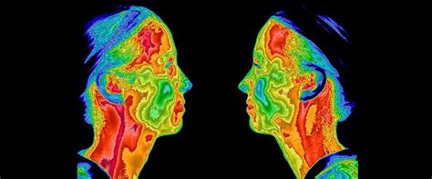 Medical Infrared Imaging – IACT