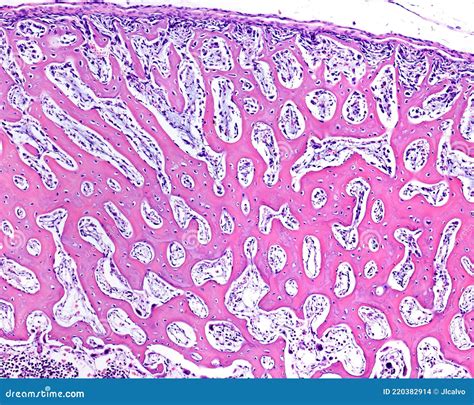 Intramembranous Ossification. Woven Bone Stock Photo - Image of histology, immature: 220382914