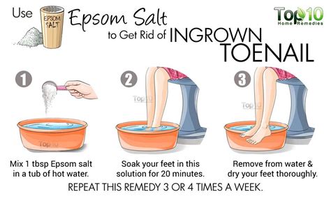 Home Remedies for Ingrown Toenails | Top 10 Home Remedies