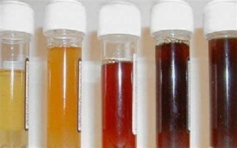 The Color of Urine Reveals the Condition of the Body - HealthInaSecond.com