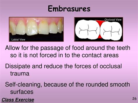 PPT - Dental Terminology Part 2 PowerPoint Presentation, free download - ID:6706096