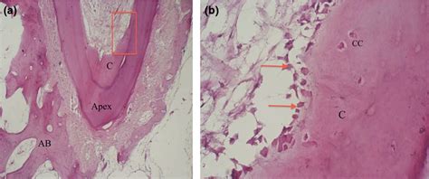 Apical Foramen Histology