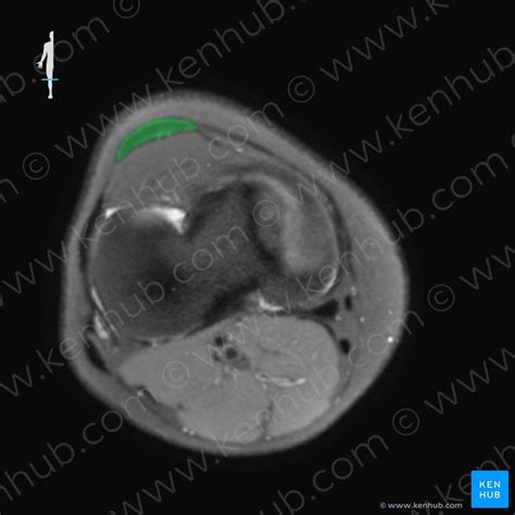 Patellar Ligament Anatomy