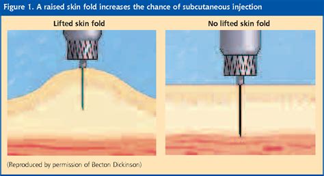 Figure 1 from Subcutaneous insulin injection technique. | Semantic Scholar