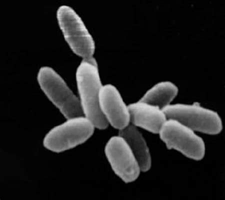 Methanogenic Archaea