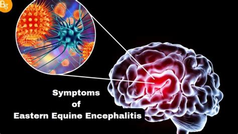 Understanding Eastern Equine Encephalitis: Symptoms, Causes, And Prevention | Badbola