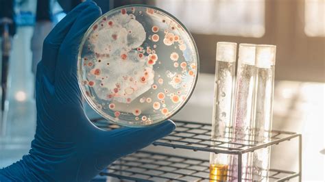 Microbiology Culture Market - Industry Size, Share, Trends (2021-2027)