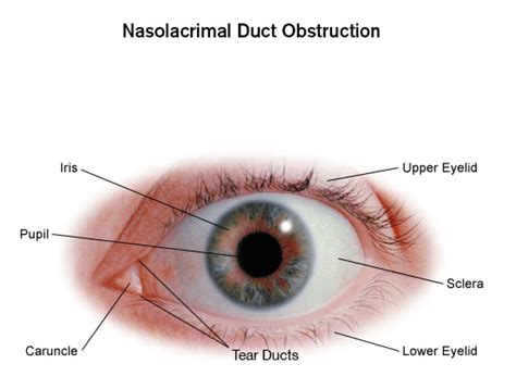 Lacrimal Duct