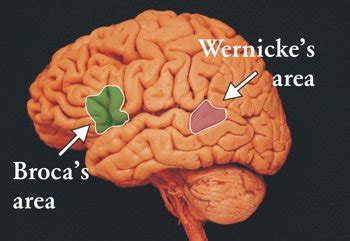 Overview of Aphasia