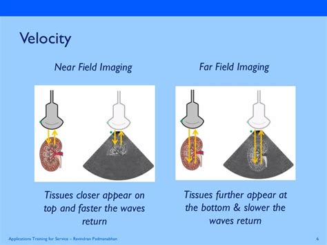 Basics Physics of ultrasound