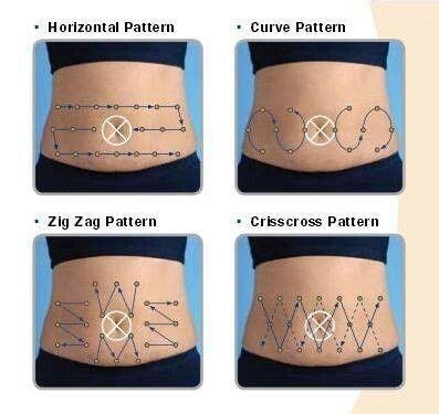 Injection site map for tummy | Type 1 diabetes, Type one diabetes, Reverse diabetes