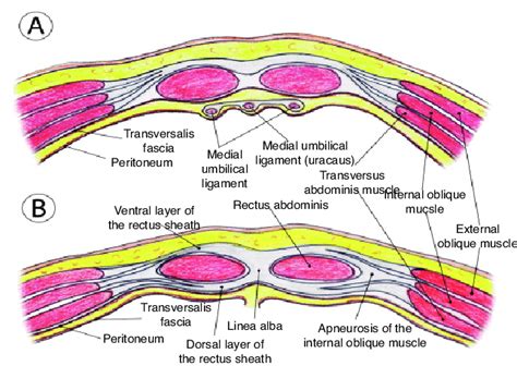 Transverse sections of the anterior abdominal wall. (A) Below the... | Download Scientific Diagram