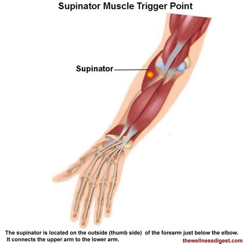 Supinator Muscle Pain - The Wellness Digest