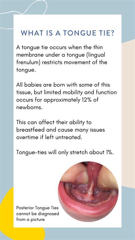 The Impact of Tongue Ties & Oral Restrictions — Sunnyseed