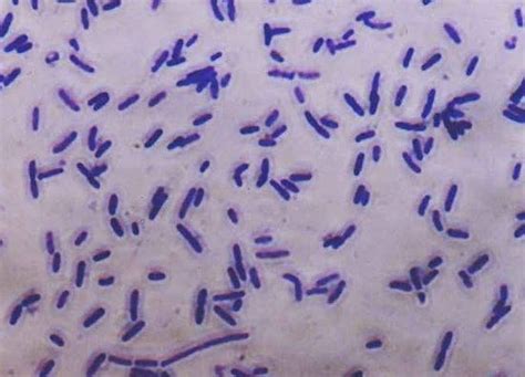 Bacillus Megaterium Acid Fast Stain