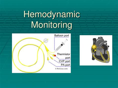 PPT - Hemodynamic Monitoring PowerPoint Presentation, free download - ID:4750943