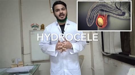 Hydrocele cause,treatments,all in hindi by uds world - YouTube