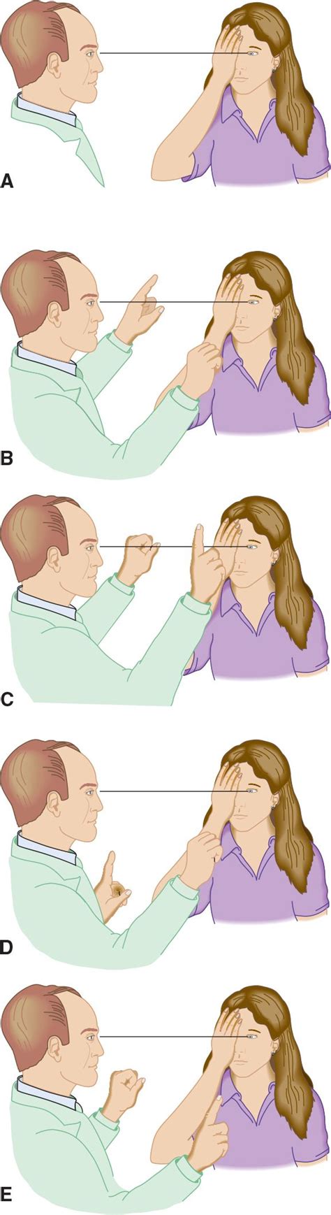 Neuro-Ophthalmic Disorders | Neupsy Key