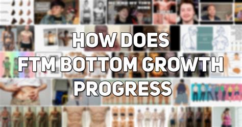 How Does FtM Bottom Growth Progress