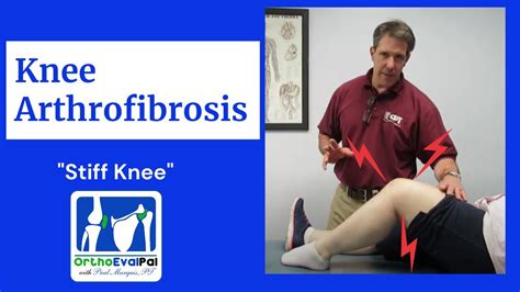 How to Treat an Arthrofibrotic Knee in Physical Therapy - YouTube