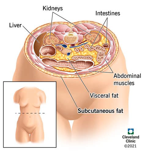 Subcutaneous Fat Surgery