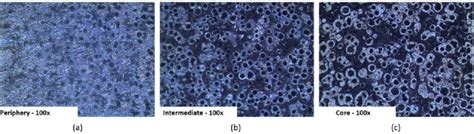 Microstructures of the nodular cast iron with low silicon content; (a ...