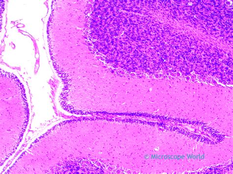 Microscope World Blog: Cerebellum under the Microscope