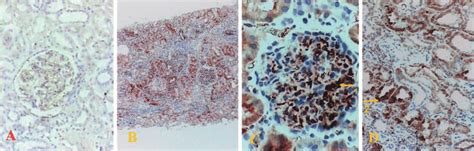 Representative photomicrographs of soluble tissue transglutaminase ...