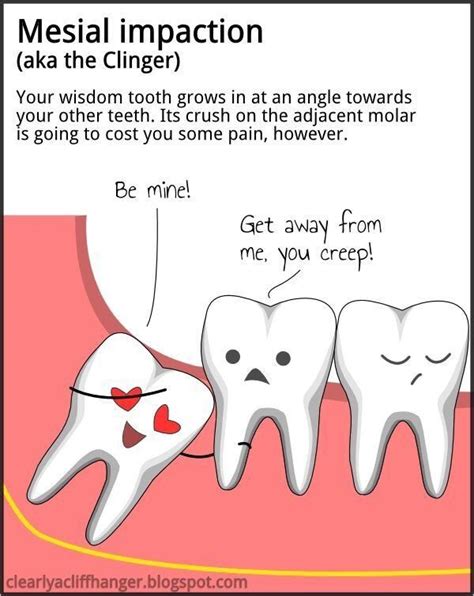 Wisdom Teeth Removal Funny Quotes - ShortQuotes.cc