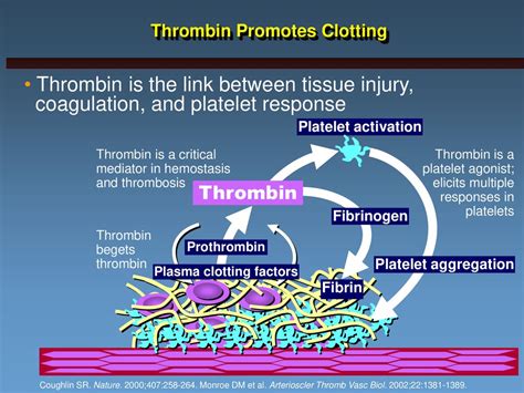 Antithrombin Therapy in the Management of ACS - ppt download