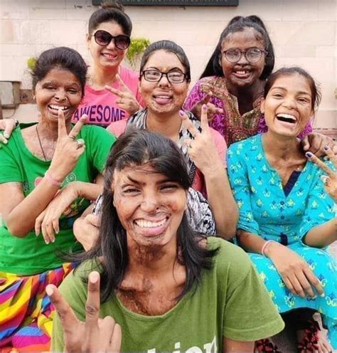 Acid attack survivors : r/MorbidReality