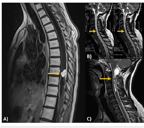 Image-based differential diagnosis (A) Magnetic resonance imaging, T1... | Download Scientific ...