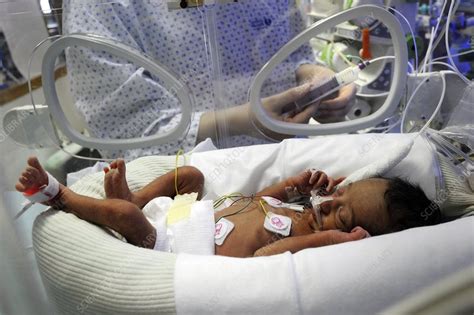 Premature baby feeding - Stock Image - C016/8723 - Science Photo Library