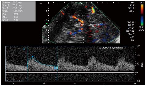 Transcranial Doppler ultrasonography: From methodology to major clinical applications