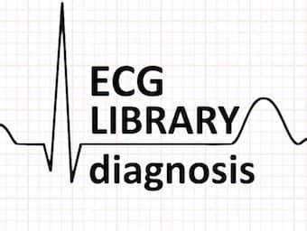 Inappropriate Sinus Tachycardia Archives • LITFL