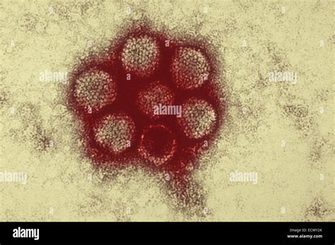 Electron micrograph of canine adenovirus type-1 (CAV-1 Stock Photo, Royalty Free Image: 76787387 ...