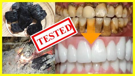 How To Whiten Teeth At Home NATURALLY In 3 Minutes Using Charcoal (2020 ...