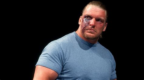 Five times WWE pushed crazy injuries like Rey Mysterio's popped out eye ...