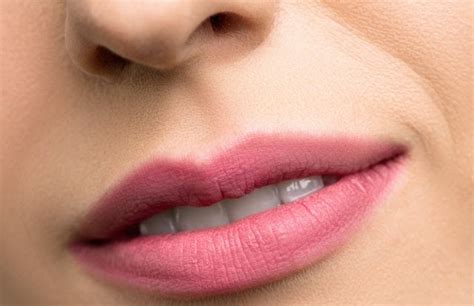 How to Get Rid of Vertical Wrinkles above the Upper Lip: Best Treatments for Smokers Lines