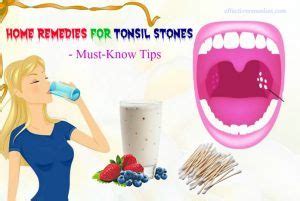 24 Effective Home Remedies For Tonsil Stones In Adults & Children